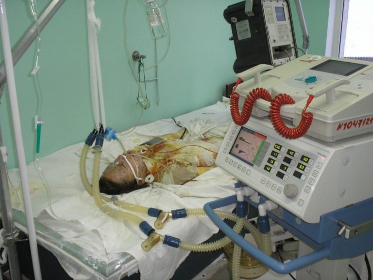 Состояние 2 учащихся, пострадавших при взрыве в Левашинском районе РД, стабилизировалось