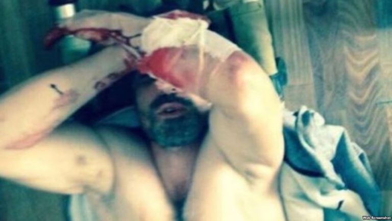 В Дагестане начальник РОВД задержан за пытки к задержанным
